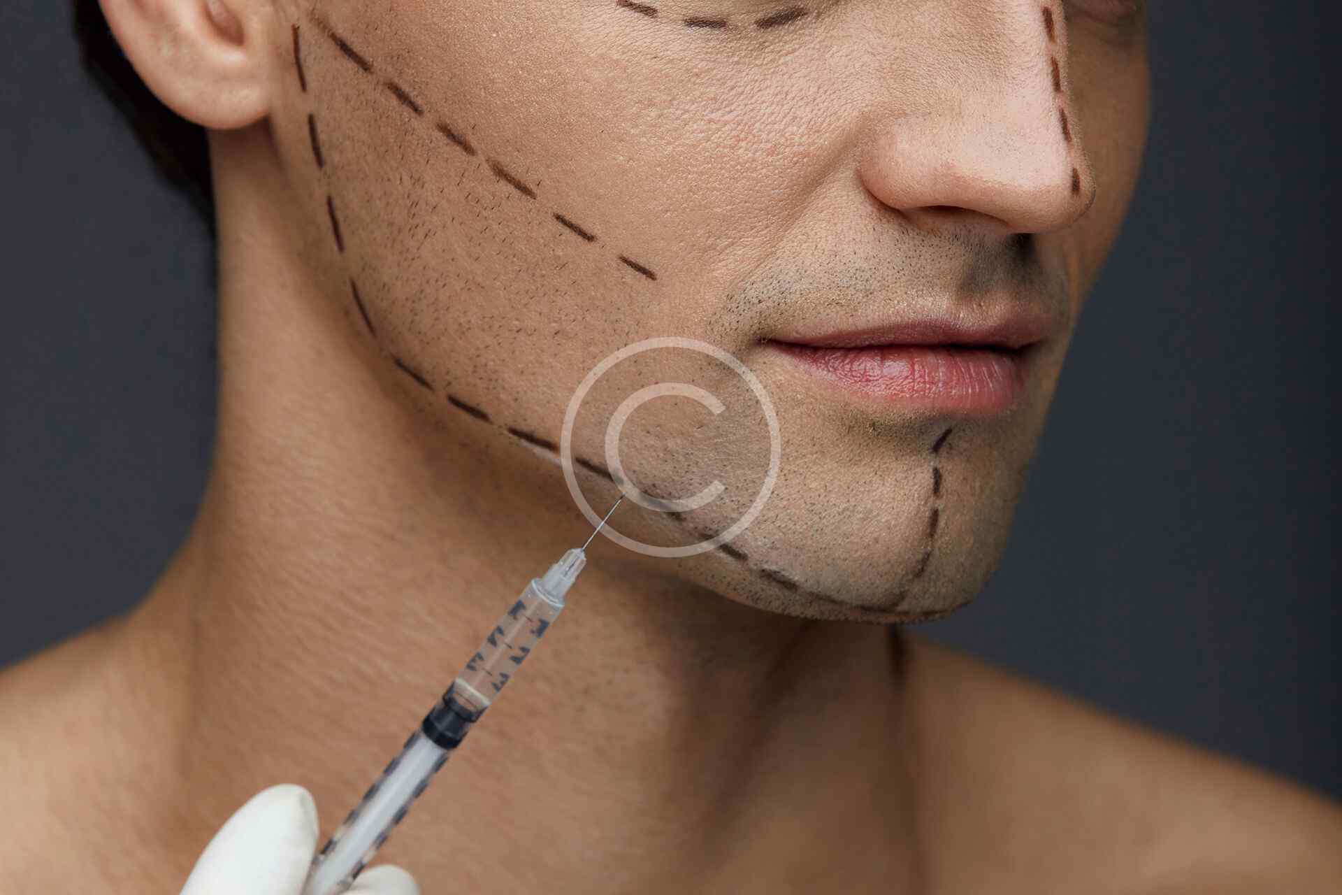 Early Detection Fremantle Skin Cancer Clinic