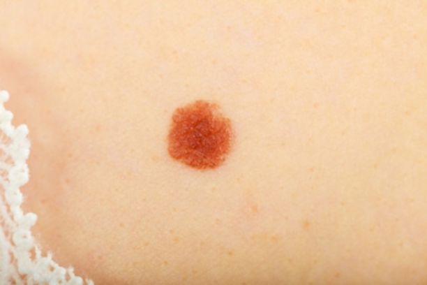 Non-invasive Topical Treatments