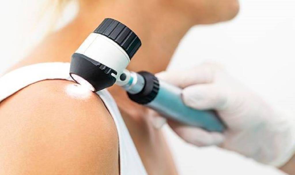 Skin cancer checks