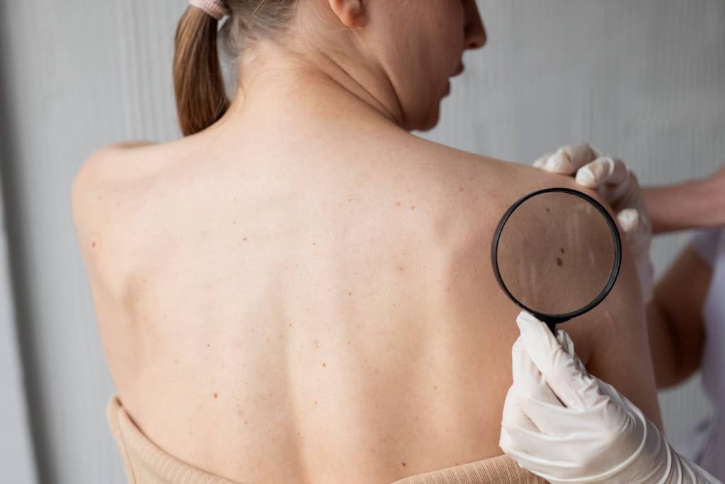 female-doctor-diagnosing-melanoma-body-female-patient-1024x684