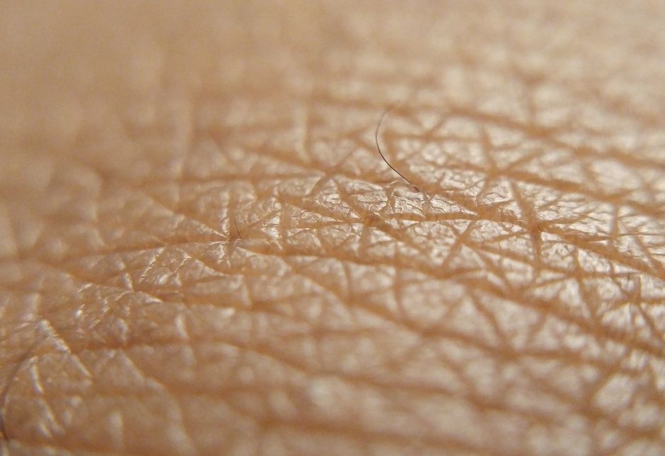 Dermatologist-led treatment for severe acne including isotretinoin and scar management